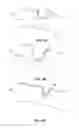 Fig. 09 - Trenched sealing retainer for canal hearing device