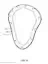 Fig. 12 - Trenched sealing retainer for canal hearing device