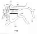 Fig. 04 - Ear canal earpiece and earmold unit for an earpiece
