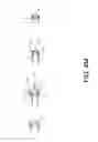 Fig. 34 - Housing for encasing an electronic device