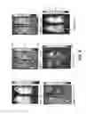 Fig. 07 - Animal Model Expressing Luciferase under Control of the Myelin Basic Protein Promoter (MBP-luci) and Use of the Model for Bioluminescence In Vivo Imaging