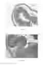 Fig. 09 - PERFUSION SYSTEMS AND METHODS OF PERFUSING AT LEAST A PORTION OF A SMALL INTESTINE