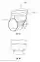 Fig. 09 - Underwear brief