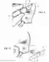 Fig. 04 - Attachment system for a helmet