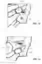 Fig. 10 - Attachment system for a helmet