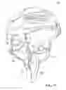 Fig. 11 - Attachment system for a helmet