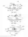 Fig. 13 - SHOES