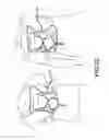 Fig. 11 - Bag apparatus