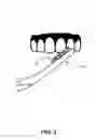 Fig. 04 - Toothbrush Head with Fabric Pad for Improved Teeth Cleaning