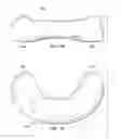 Fig. 04 - Nursing Pillow