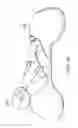 Fig. 10 - Nursing Pillow