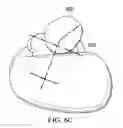 Fig. 12 - Nursing Pillow