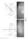 Fig. 06 - Robotic control of an endoscope from anatomical features