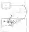Fig. 01 - DEVICES AND METHODS FOR MINIMALLY INVASIVE ARTHROSCOPIC SURGERY