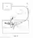 Fig. 02 - DEVICES AND METHODS FOR MINIMALLY INVASIVE ARTHROSCOPIC SURGERY