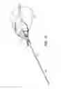 Fig. 04 - DEVICES AND METHODS FOR MINIMALLY INVASIVE ARTHROSCOPIC SURGERY