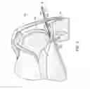 Fig. 06 - DEVICES AND METHODS FOR MINIMALLY INVASIVE ARTHROSCOPIC SURGERY