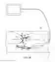 Fig. 09 - DEVICES AND METHODS FOR MINIMALLY INVASIVE ARTHROSCOPIC SURGERY