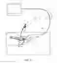 Fig. 11 - DEVICES AND METHODS FOR MINIMALLY INVASIVE ARTHROSCOPIC SURGERY