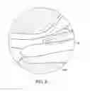 Fig. 15 - DEVICES AND METHODS FOR MINIMALLY INVASIVE ARTHROSCOPIC SURGERY