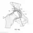 Fig. 19 - DEVICES AND METHODS FOR MINIMALLY INVASIVE ARTHROSCOPIC SURGERY