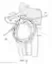 Fig. 24 - DEVICES AND METHODS FOR MINIMALLY INVASIVE ARTHROSCOPIC SURGERY