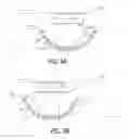 Fig. 10 - Object information acquiring apparatus