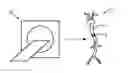 Fig. 01 - Stenosis therapy planning
