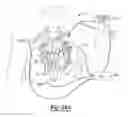 Fig. 28 - Determining a location of a member