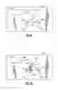 Fig. 12 - PERSONAL DIAGNOSTIC DEVICE HAVING AN AIR SAMPLE COLLECTION UNIT AND A FLUIDIC CIRCUIT