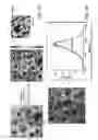 Fig. 07 - Device and method for imaging collagen structure in vivo