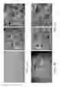 Fig. 09 - Device and method for imaging collagen structure in vivo