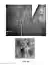 Fig. 10 - Device and method for imaging collagen structure in vivo