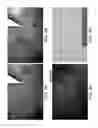 Fig. 12 - Device and method for imaging collagen structure in vivo