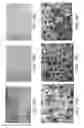 Fig. 13 - Device and method for imaging collagen structure in vivo