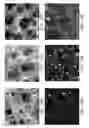 Fig. 14 - Device and method for imaging collagen structure in vivo