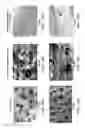 Fig. 18 - Device and method for imaging collagen structure in vivo