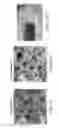 Fig. 20 - Device and method for imaging collagen structure in vivo