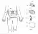 Fig. 01 - SYSTEMS AND METHODS FOR LEVERAGING SMARTPHONE FEATURES IN CONTINUOUS GLUCOSE MONITORING