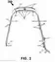 Fig. 03 - Strap band for a wearable device