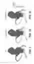 Fig. 08 - Method and system for quantifying limitations in coronary artery blood flow during physical activity in patients with coronary artery disease