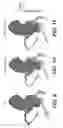 Fig. 08 - METHOD AND SYSTEM FOR QUANTIFYING LIMITATIONS IN CORONARY ARTERY BLOOD FLOW DURING PHYSICAL ACTIVITY IN PATIENTS WITH CORONARY ARTERY DISEASE