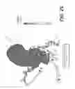 Fig. 16 - METHOD AND SYSTEM FOR QUANTIFYING LIMITATIONS IN CORONARY ARTERY BLOOD FLOW DURING PHYSICAL ACTIVITY IN PATIENTS WITH CORONARY ARTERY DISEASE