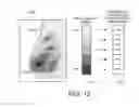 Fig. 13 - Displaying computer-aided detection information with associated breast tomosynthesis image information