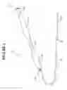 Fig. 02 - Needle biopsy device