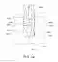 Fig. 35 - Suture anchor
