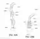 Fig. 41 - Suture anchor