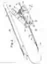 Fig. 03 - BONE ANCHOR INSERTION DEVICE