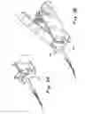 Fig. 04 - BONE ANCHOR INSERTION DEVICE