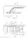 Fig. 05 - Longitudinal needle passer